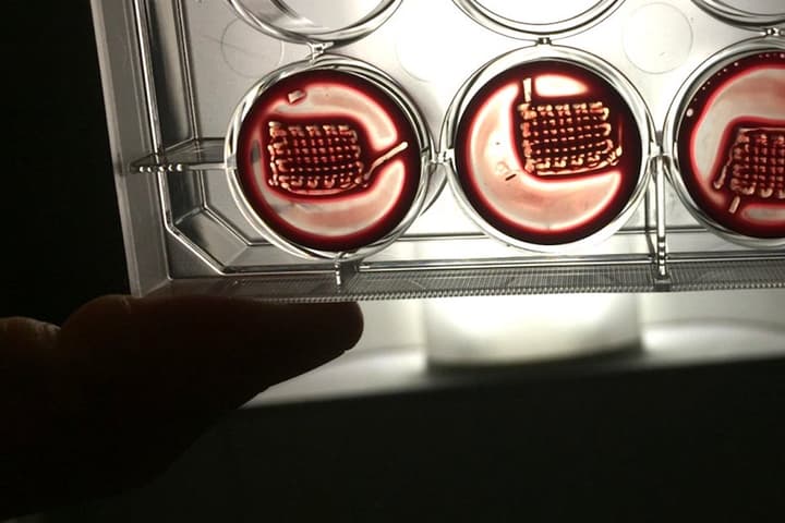 Samples of the new blood-based, 3D-printable implants that can aid healing