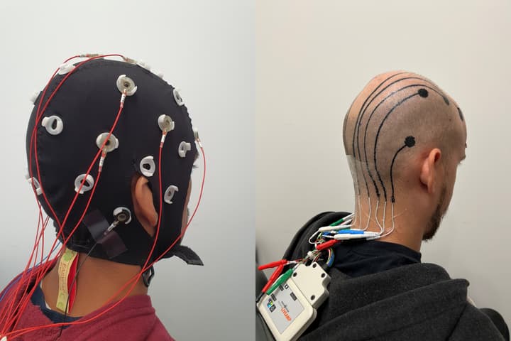 A conventional EEG skull cap (left) alongside the much more mobile e-tattoos