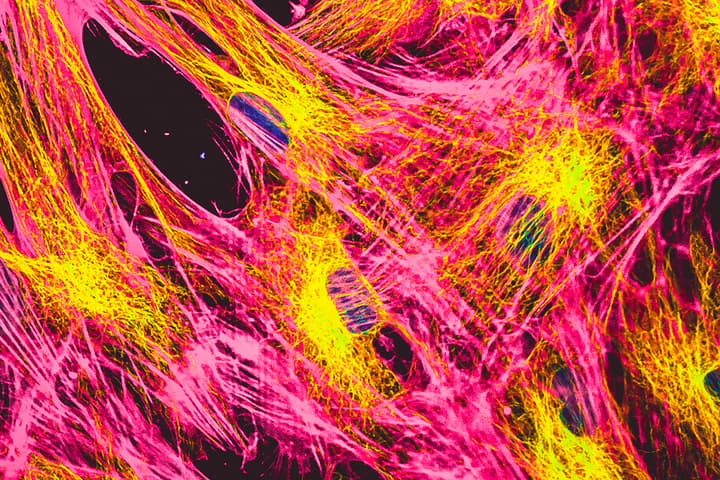 Actin filaments (pink) are affected by aging, but can be switched off via genes