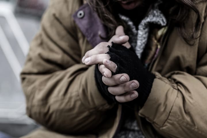 Homeless people are frequent victims of frostbite, and often lack the means of obtaining treatment