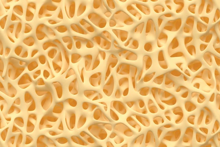 When exposed to harmless visible light, the hydrogel becomes a porous solid that promotes the growth of natural bone tissue (pictured)