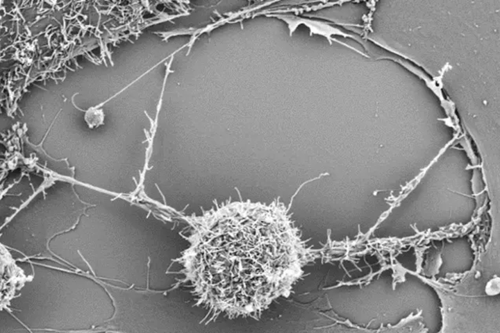 Giving immune cells extra "batteries" helps them fight cancer more effectively