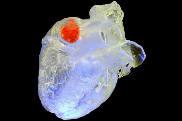 A solidified sono-ink structure (red) printed inside a heart model