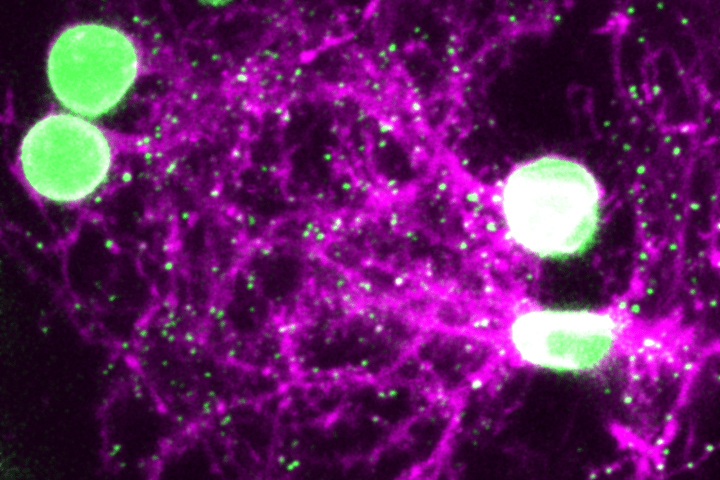 A microscope image of a zebrafish brain, with synapses highlighted in green