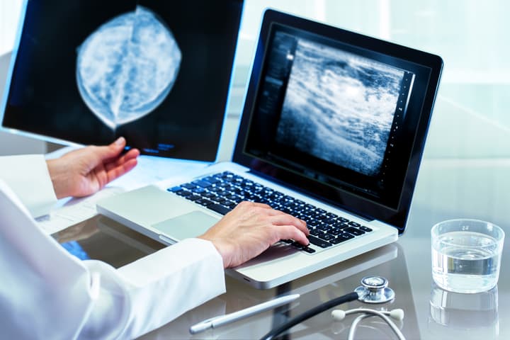 A new study has found that using AI to support radiologists screening mammograms is safe and does not lead to false positives