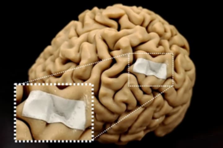 A biodegradable paper can deliver wireless electrical stimulation to the brain